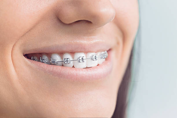Best Traditional Braces  in Tullahoma, TN